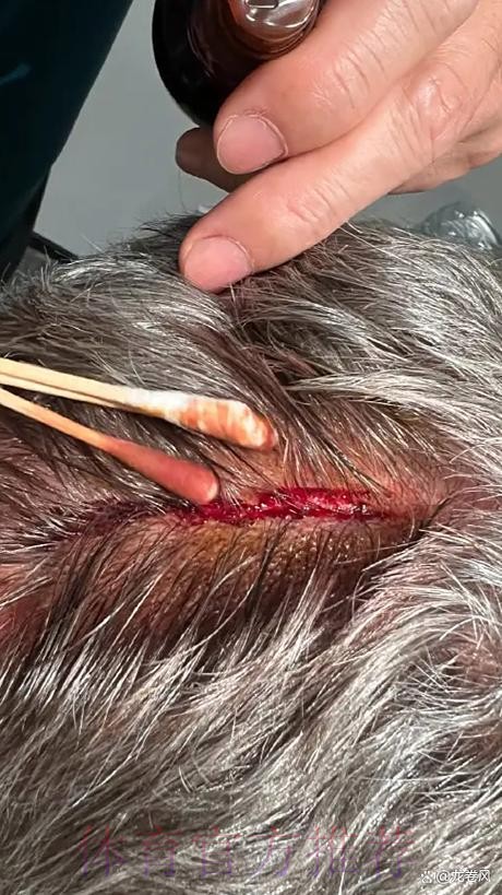 引援结束!安帅:球队阵容完整 就这样等转会市场关闭